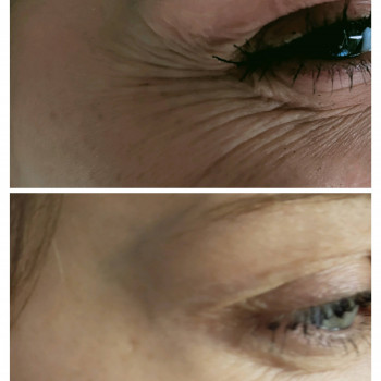 Тетяна Дем'яник, Богородчани Фото - 11