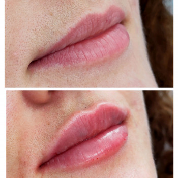 Тетяна Дем'яник, Богородчани Фото - 14