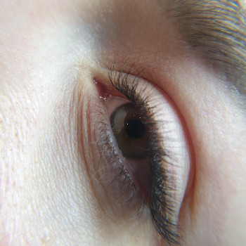 Класичне нарощування