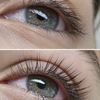 Фото до та після!