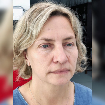 Перманентний макіяж брів
                    Косметолог-естетист Ольга Чернігів