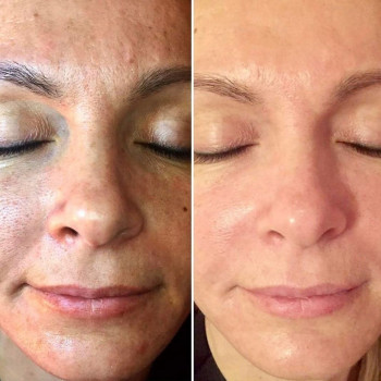 Дарья Рублева, Одеса Фото - 9