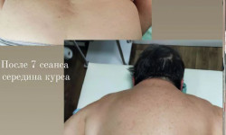 Масаж розслабляючий шийно комірцева зона Масажист Владислав Київ