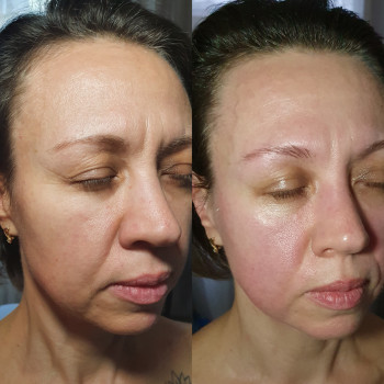 Авторський масаж обличчя
                    Салон красоты Body and face sculpture Киев