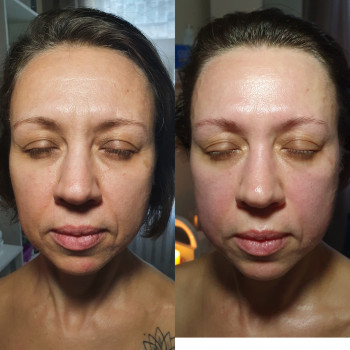 Авторський масаж обличчя
                    Салон красоты Body and face sculpture Киев