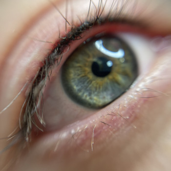 Міжвійка після процедури