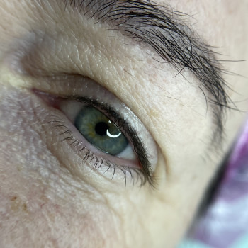 Загоєний перманент міжвійки (одна процедури)