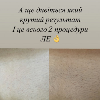 Estetika Studio, Нежин Фото - 7