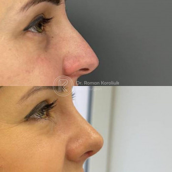 Роман Королюк, Київ Фото - 6