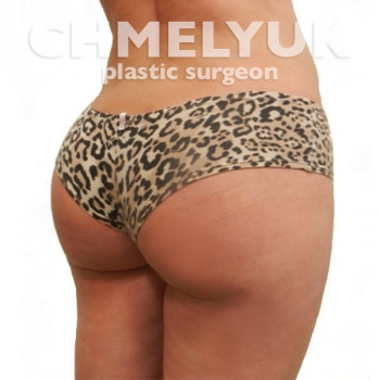 Ігор Чмелюк, Київ Фото - 5