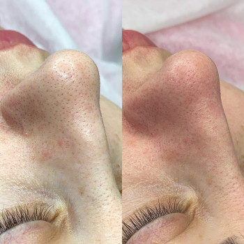 Руслана Хворостенко, Черкаси Фото - 20