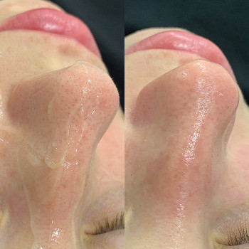 Руслана Хворостенко, Черкаси Фото - 21