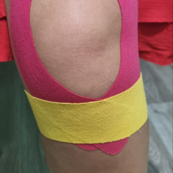 Кінезіотейпування / Кинезиотейпирование
                    Массажист Ирина Днепр