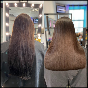 Биксипластия