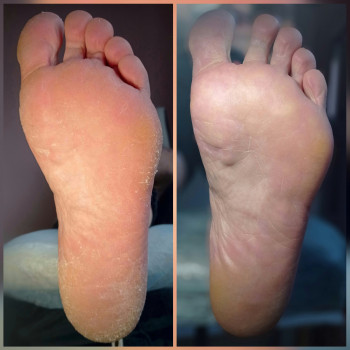 Анна Нестеренко, Ивано-Франковск Фото - 23