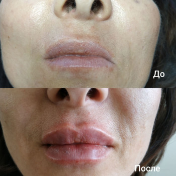 Натали Ткаченко, Киев Фото - 43