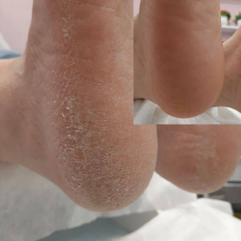 Педикюр повний
                    Ногтевая студия Heiko Nails Днепр