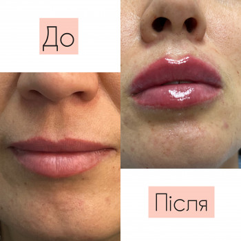 Зволоження губ