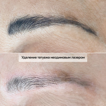 Лариса Туманян, Киев Фото - 22