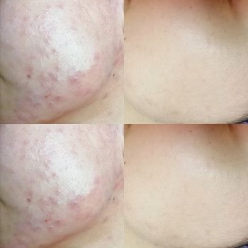 Анна Ваврик, Одесса Фото - 13