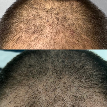 Анна Ваврик, Одесса Фото - 14