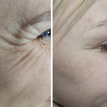 Юлия Злочевская, Белая Церковь Фото - 13