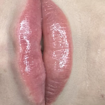 Збільшення губ. Косметологія
                    Тату мастер Анна Коломыя