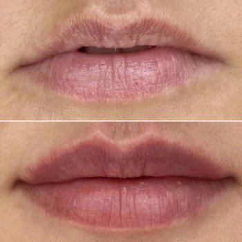 Марина Супрун, Запорожье Фото - 11