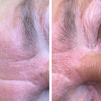 Electro Epil Angels, Чернигов Фото - 5