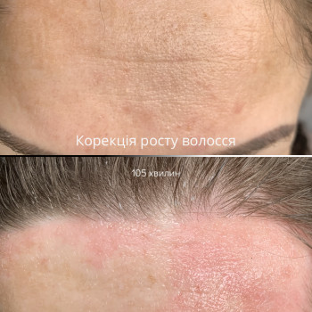 Electro Epil Angels, Чернигов Фото - 6