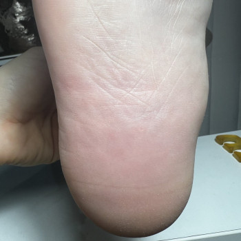 Педикюр
                    Салон краси Мастерская красоты "Queen" Київ