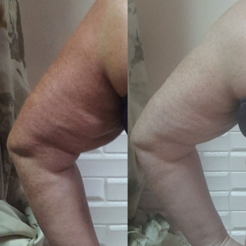 Программа похудения "Стройность и красота!"
                    Косметологічний центр Майстерня краси та здоров'я Slim Дніпро