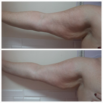 Программа похудения "Стройность и красота!"
                    Косметологічний центр Майстерня краси та здоров'я Slim Дніпро