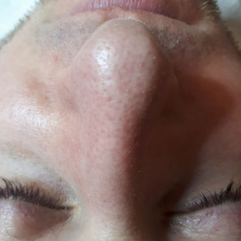 Чистка чоловіка До