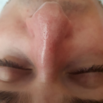 Чистка чоловіка Після