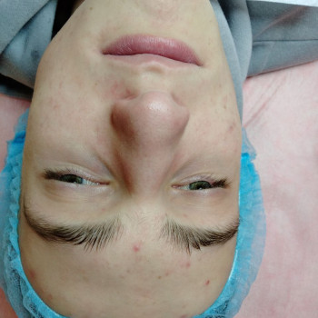 Ультразвукова чистка обличчя
                    Салон краси Flower lady Черкаси