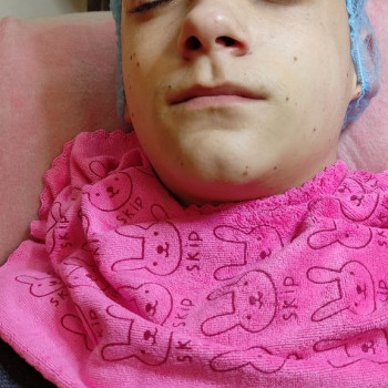 Ультразвукова чистка обличчя
                    Салон краси Flower lady Черкаси