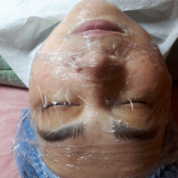 Ультразвукова чистка обличчя
                    Салон краси Flower lady Черкаси