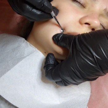 Механічна чистка обличчя
                    Салон красоты Flower lady Черкассы