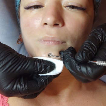 Механічна чистка обличчя
                    Салон красоты Flower lady Черкассы