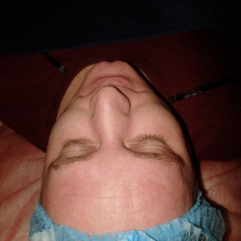 Ультразвукова чистка обличчя
                    Салон краси Flower lady Черкаси