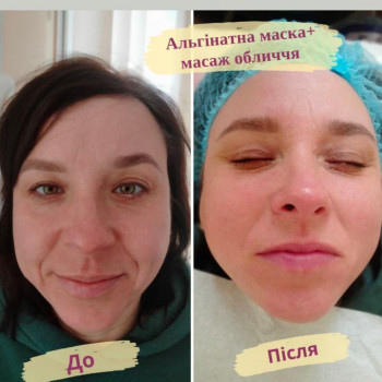 Масаж обличчя
                    Салон красоты Flower lady Черкассы