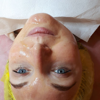 Ультразвукова чистка обличчя
                    Салон краси Flower lady Черкаси