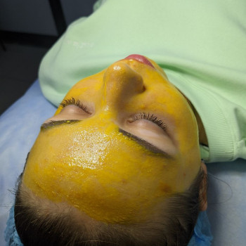 Мікротокова терапія
                    Салон красоты Flower lady Черкассы