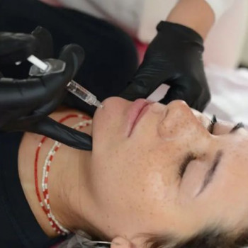 Збільшення підборіддя филлером ( Г.К.).
2 мл.