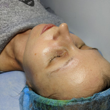 Гідропілінг
                    Салон краси Flower lady Черкаси