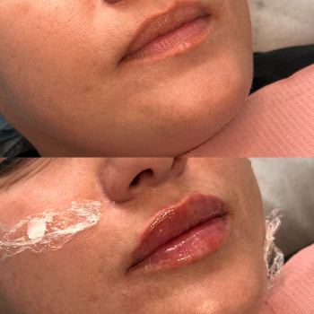 Яна Кроль, Черновцы Фото - 7