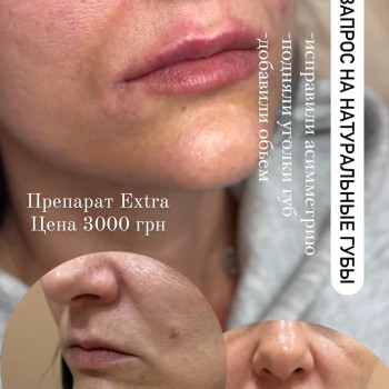 Наталья Анжуйская, Запоріжжя Фото - 3