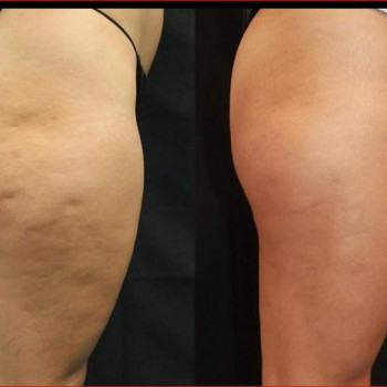 Наталья Анжуйская, Запоріжжя Фото - 5