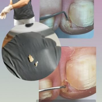 Тетяна Сметанка, Одеса Фото - 61